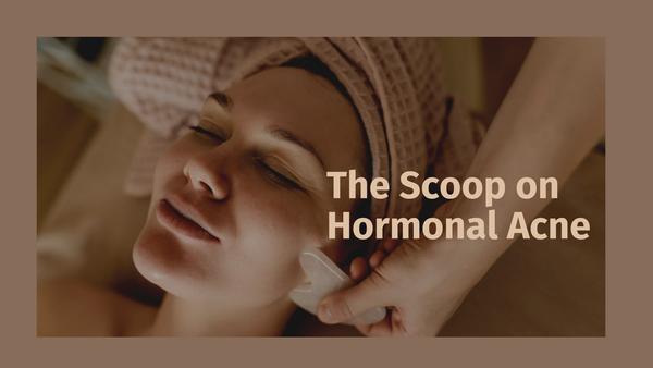The Scoop on Hormonal Acne